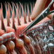 Hair Treatment Myths Explained: Discover the Truth